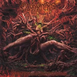 Ecchymosis