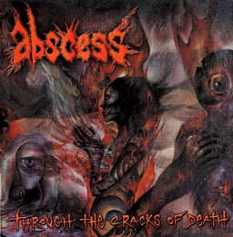Abscess